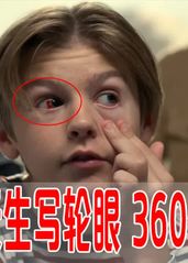 男孩天生写轮眼，能3600度旋转，却因使用过度，双目失明，看天才医生怎么救治？